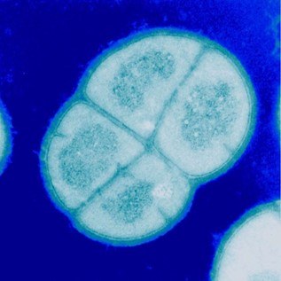 MicroTalks - Conferencias de Microbiología: Astrobiología + sistemas de vigilancia de pandemias